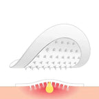 ClearSkin Pro – 3-in-1 Microneedle Bundle